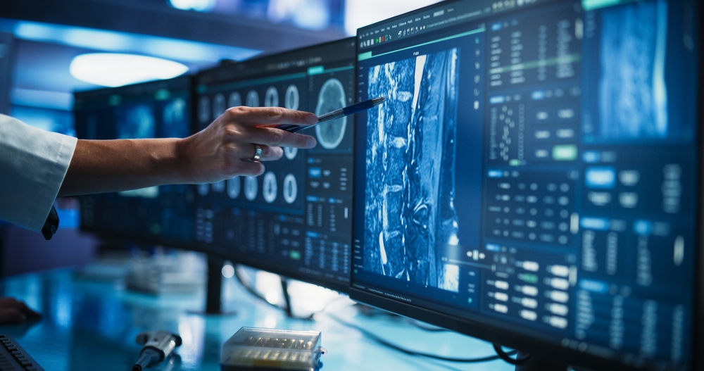 doctor pointing a pen at an MRI